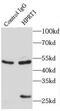 Hypoxanthine-guanine phosphoribosyltransferase antibody, FNab03997, FineTest, Immunoprecipitation image 