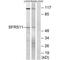 Serine And Arginine Rich Splicing Factor 11 antibody, A09323, Boster Biological Technology, Western Blot image 