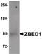 Zinc Finger BED-Type Containing 1 antibody, PA5-20732, Invitrogen Antibodies, Western Blot image 