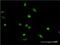 DNA repair protein XRCC2 antibody, H00007516-M01, Novus Biologicals, Immunocytochemistry image 