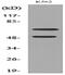 Histidine Decarboxylase antibody, A01876, Boster Biological Technology, Western Blot image 