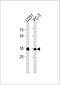 60S acidic ribosomal protein P0-like antibody, PA5-35261, Invitrogen Antibodies, Western Blot image 