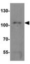 Centrosomal protein CP110 antibody, GTX31479, GeneTex, Western Blot image 