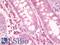 SUZ12 Polycomb Repressive Complex 2 Subunit antibody, LS-B10186, Lifespan Biosciences, Immunohistochemistry frozen image 