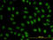 BCL9 Transcription Coactivator antibody, LS-C196739, Lifespan Biosciences, Immunofluorescence image 