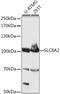 Sodium/calcium exchanger 2 antibody, A15723, ABclonal Technology, Western Blot image 