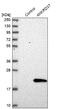 LPR2BP antibody, NBP1-82819, Novus Biologicals, Western Blot image 