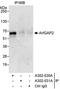 ADP Ribosylation Factor GTPase Activating Protein 2 antibody, A302-030A, Bethyl Labs, Immunoprecipitation image 