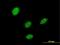 LIM/homeobox protein Lhx5 antibody, MA5-22476, Invitrogen Antibodies, Immunofluorescence image 