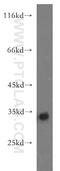 Four And A Half LIM Domains 3 antibody, 11028-2-AP, Proteintech Group, Western Blot image 
