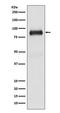 SATB Homeobox 2 antibody, M02588, Boster Biological Technology, Western Blot image 