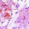 ATP Binding Cassette Subfamily C Member 1 antibody, orb377889, Biorbyt, Immunohistochemistry paraffin image 