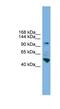 Protocadherin-18 antibody, NBP1-79315, Novus Biologicals, Western Blot image 