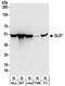 Dihydrolipoamide S-Succinyltransferase antibody, NBP2-32204, Novus Biologicals, Western Blot image 