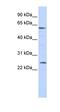 Chromaffin granule amine transporter antibody, orb324613, Biorbyt, Western Blot image 