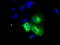 Vesicle Amine Transport 1 Like antibody, TA501107, Origene, Immunofluorescence image 