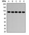 Receptor-type tyrosine-protein phosphatase epsilon antibody, abx142181, Abbexa, Western Blot image 