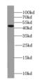 Septin-2 antibody, FNab07721, FineTest, Western Blot image 