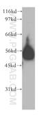 Ectonucleotide Pyrophosphatase/Phosphodiesterase 6 antibody, 12643-1-AP, Proteintech Group, Western Blot image 