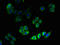 3-Hydroxy-3-Methylglutaryl-CoA Reductase antibody, orb239800, Biorbyt, Immunofluorescence image 