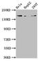 Complement C4-A antibody, LS-C674437, Lifespan Biosciences, Western Blot image 
