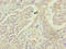Mitochondrial Ribosomal Protein S22 antibody, LS-C676074, Lifespan Biosciences, Immunohistochemistry paraffin image 