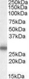 Myelin Protein Zero antibody, NB100-94909, Novus Biologicals, Western Blot image 