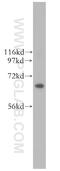 Cell Division Cycle 6 antibody, 11640-1-AP, Proteintech Group, Western Blot image 