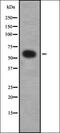 Chondroitin Sulfate N-Acetylgalactosaminyltransferase 1 antibody, orb378454, Biorbyt, Western Blot image 