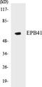 Erythrocyte Membrane Protein Band 4.1 antibody, EKC1189, Boster Biological Technology, Western Blot image 