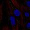 Chromosome 11 Open Reading Frame 91 antibody, PA5-65463, Invitrogen Antibodies, Immunofluorescence image 