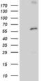 Proteasome 26S Subunit, Non-ATPase 3 antibody, MA5-25873, Invitrogen Antibodies, Western Blot image 