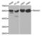 Thromboxane A Synthase 1 antibody, abx001620, Abbexa, Western Blot image 