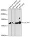 Collagen Type I Alpha 1 Chain antibody, 15-039, ProSci, Western Blot image 