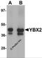 Y-Box Binding Protein 2 antibody, 5885, ProSci, Western Blot image 