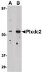 Plexin domain-containing protein 2 antibody, PA5-20466, Invitrogen Antibodies, Western Blot image 