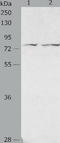 ADAM Metallopeptidase Domain 20 antibody, TA322822, Origene, Western Blot image 