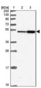F-Box And Leucine Rich Repeat Protein 20 antibody, NBP2-48960, Novus Biologicals, Western Blot image 