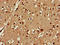Centrosomal Protein 19 antibody, LS-C677501, Lifespan Biosciences, Immunohistochemistry paraffin image 