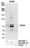 MAGUK p55 subfamily member 5 antibody, A305-389A, Bethyl Labs, Immunoprecipitation image 