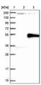 Neuraminidase 1 antibody, PA5-53351, Invitrogen Antibodies, Western Blot image 