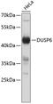 Dual Specificity Phosphatase 6 antibody, 13-231, ProSci, Western Blot image 