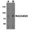 ADAM Metallopeptidase Domain 29 antibody, TA349173, Origene, Western Blot image 