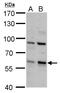 Cyclin Dependent Kinase 17 antibody, GTX108880, GeneTex, Western Blot image 