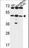 UDP-GlcNAc:betaGal beta-1,3-N-acetylglucosaminyltransferase 5 antibody, LS-C156712, Lifespan Biosciences, Western Blot image 