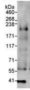 Histone-lysine N-methyltransferase, H3 lysine-79 specific antibody, ab72454, Abcam, Immunoprecipitation image 
