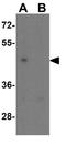 Leucine Rich Repeat Containing 26 antibody, GTX31897, GeneTex, Western Blot image 