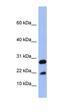 Fatty Acid Binding Protein 4 antibody, orb329746, Biorbyt, Western Blot image 