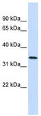 Annexin A4 antibody, TA341645, Origene, Western Blot image 