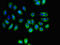 Solute Carrier Family 16 Member 8 antibody, LS-C679476, Lifespan Biosciences, Immunofluorescence image 